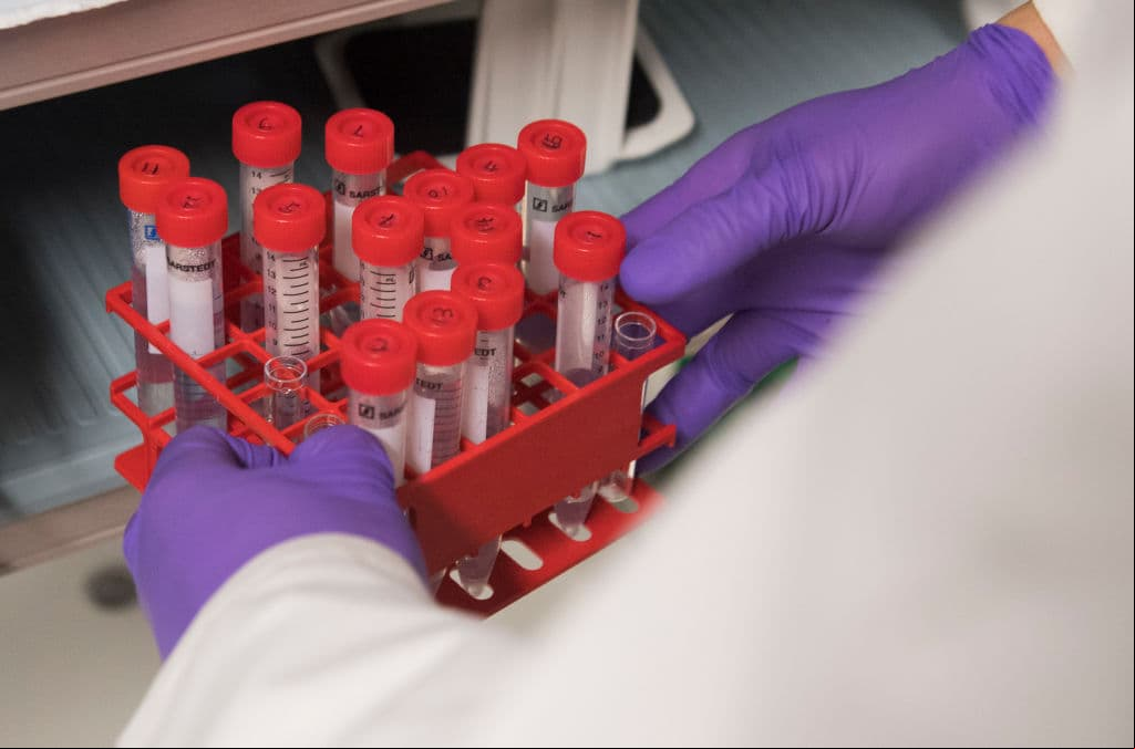 La prueba de sangre que puede alertar de la presencia de hasta 50 tipos de cáncer
